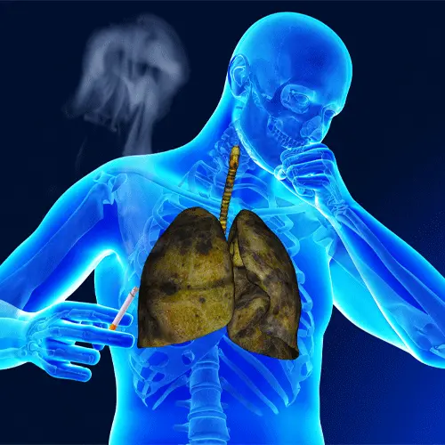 تصویر یک فرد با ریه خراب و تنگی نفس بالا