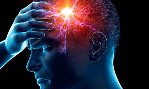 نقطه سردرد میگرنی